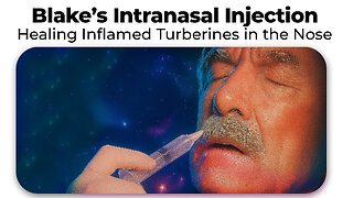 Blake’s Intranasal Injection - Healing Inflamed Turberines in the Nose - DBC Stem Cells 2025