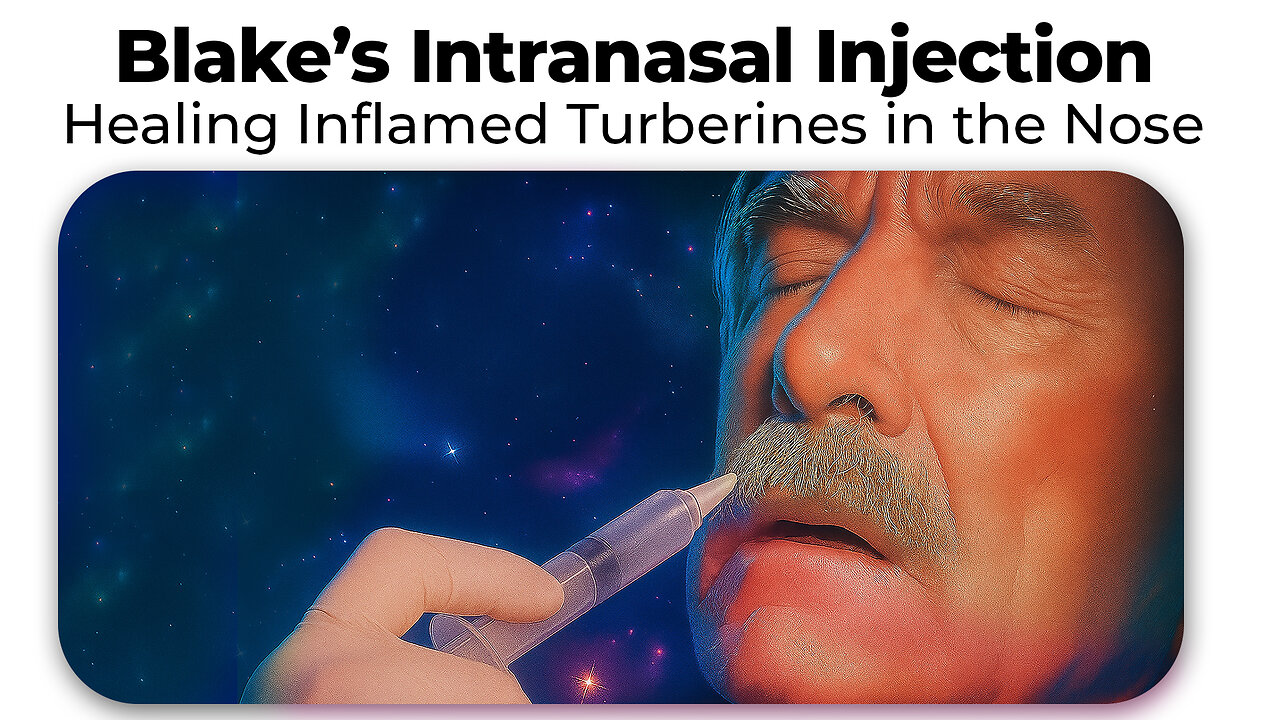 Blake’s Intranasal Injection - Healing Inflamed Turberines in the Nose - DBC Stem Cells 2025