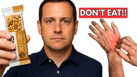 Avoid Eating These 7 Foods If You Have Psoriasis (& What You Can Eat Instead) #PsoriasisDiet