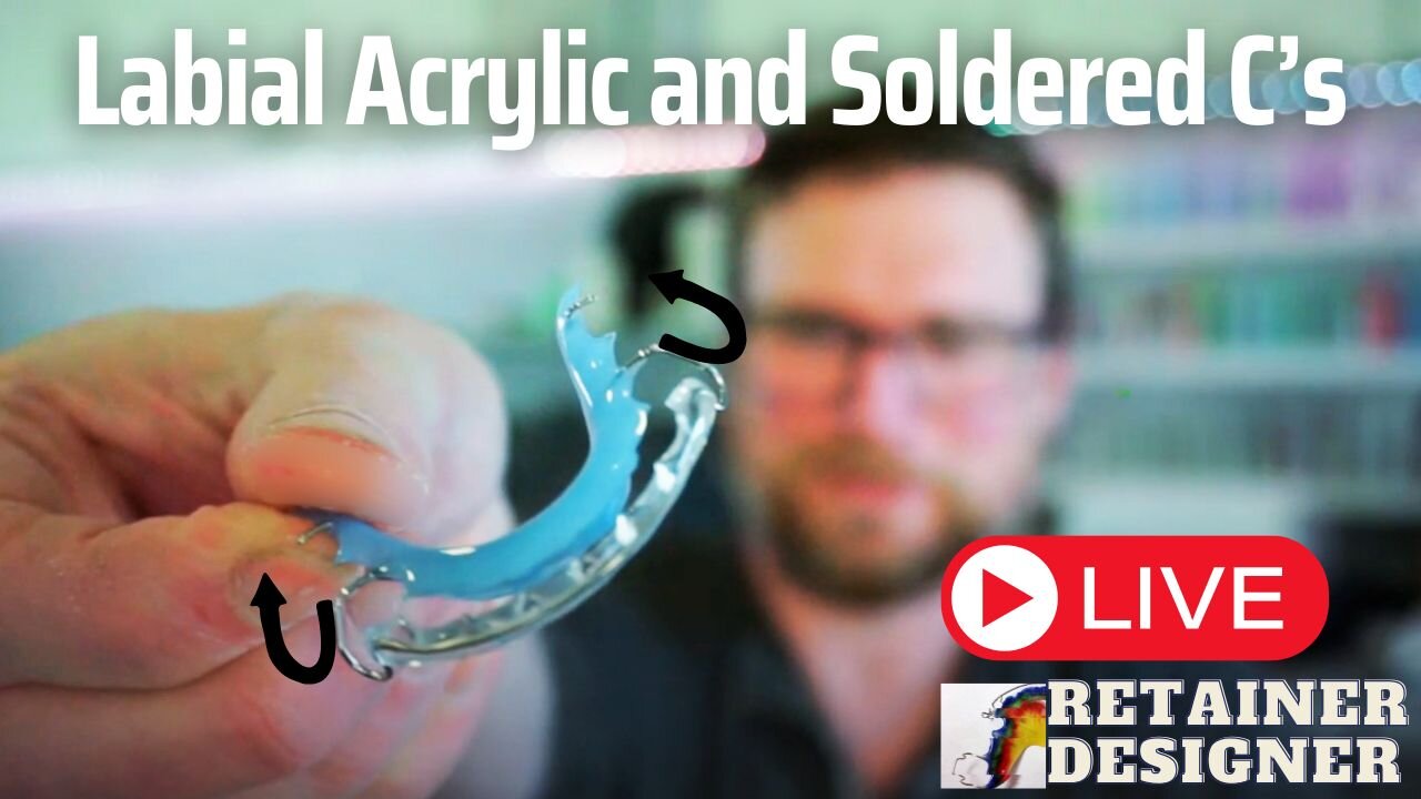 [LIVE] Full Retainer Build with Labial Acrylic & Soldered C Clasps – Start to Finish in 1 Hour!