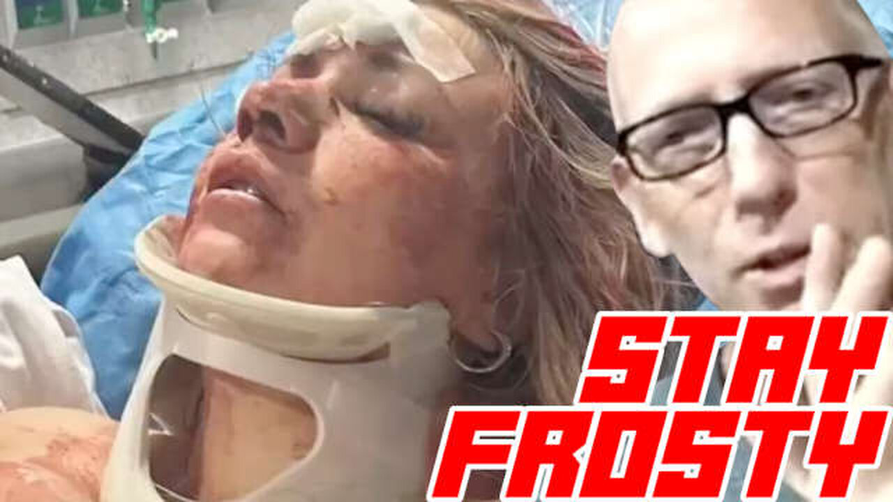 Black Man Breaks Bachelorette's Nose and Knocks Out 3 Teeth