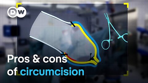 Cut, uncut - Male circumcision | DW Documentary