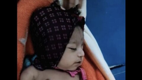 Karnataka: 2 month old baby died within 20 hours of multiple vaccinations