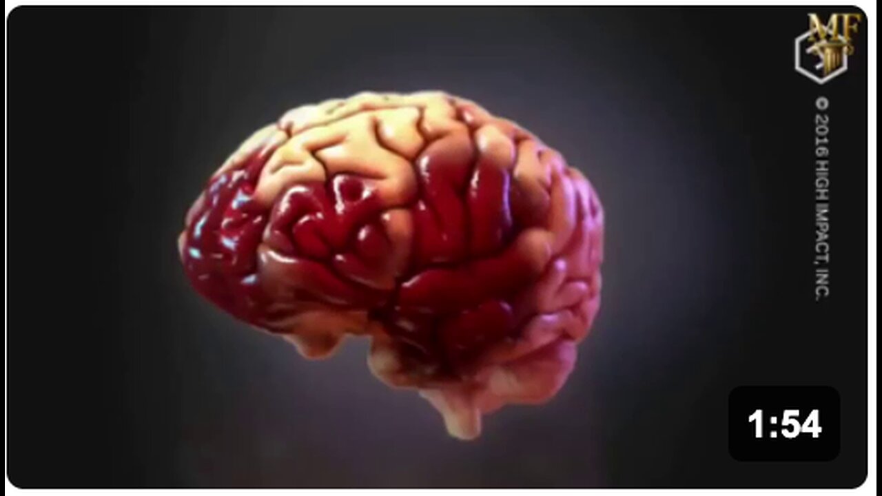 The COVID-19 mRNA shots act as chemical lobotomies