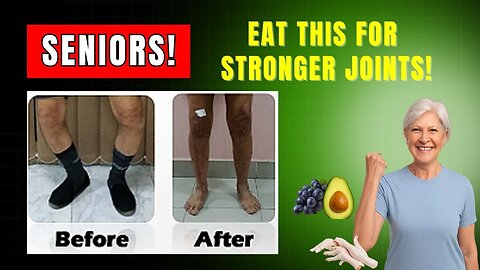 Elderly, Deflate Joint Bloat with These 15 Collagen-Fueled Foods for Mobility! B08