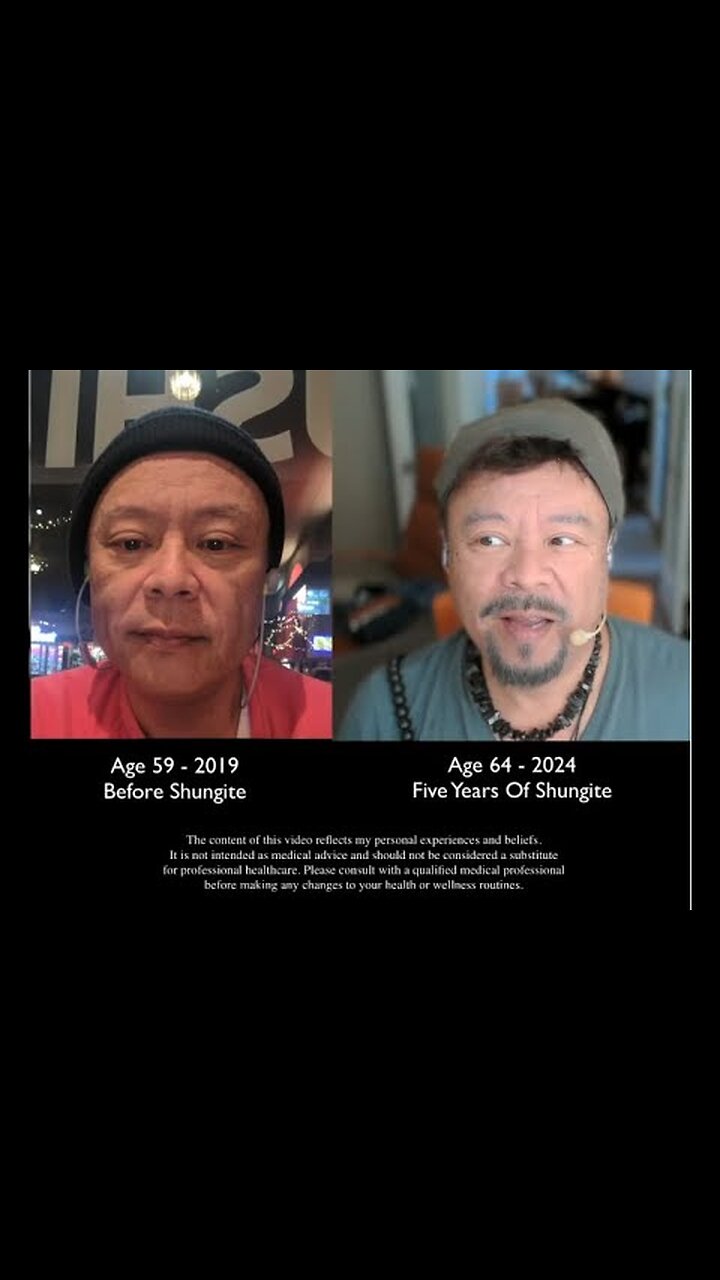 Is This PROOF That Chakras Are USB Ports for the Nervous System? How Shungite Unlocks Bioelectricity