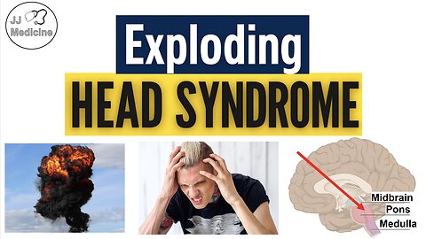 Exploding Head Syndrome (Loud Noises When Falling Asleep) | Triggers, Symptoms, Diagnosis, Treatment