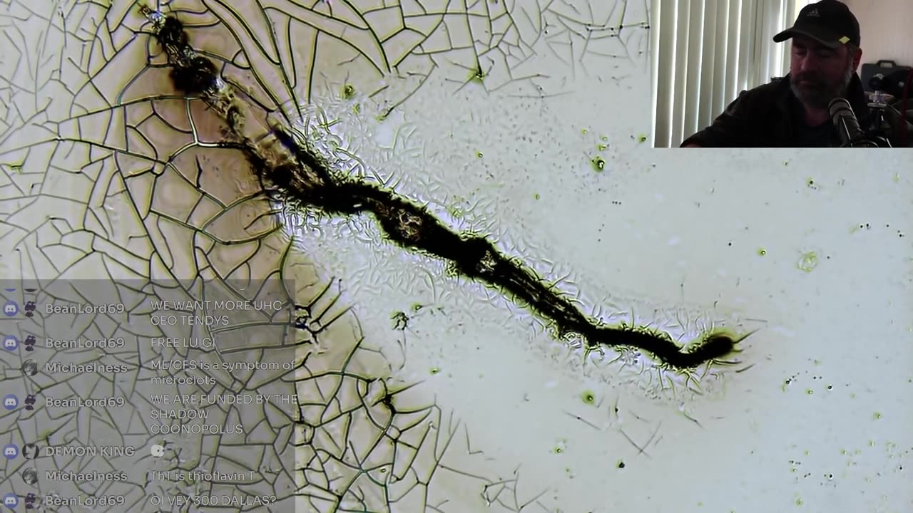 The Need For Impoving Current Amyloid Burden Testing Process and Costs (clip)