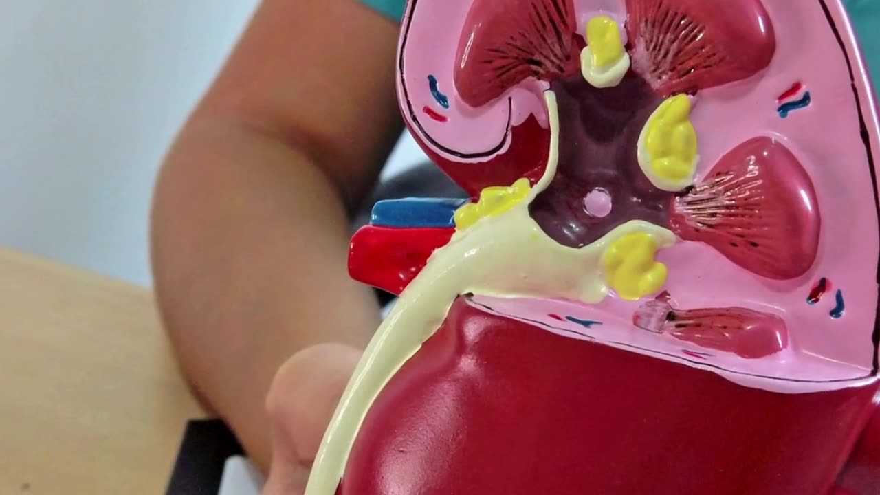Kidney Failure | Expert Kidney Problem Doctor in Madurai