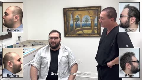 Zack’s MaxHarvest™ Plus Hair Transplant by Dr. Brett Bolton