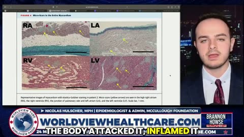Covid Vaccine’ mRNA booster shots which cause permanent damage with fatal micro-scars