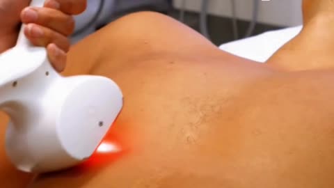 Effective Shockwave Therapy Now Available in Maple Ridge