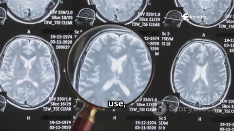 HOW MANY PEOPLE IN THE U.S. SUFFER FROM OPIOID ADDICTION?