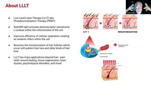 LaserCap for Hair Restoration