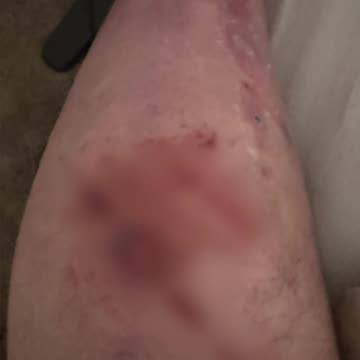 Portland Antifa: ID Checks & Attacks