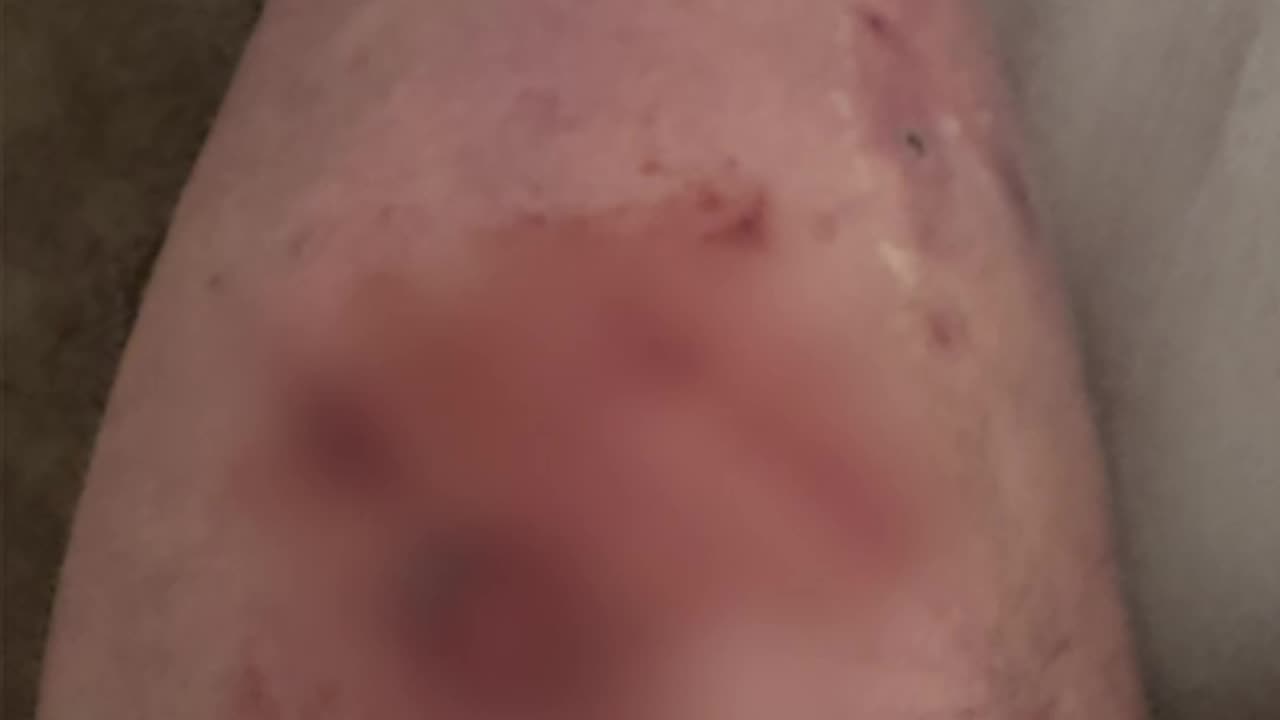 Portland Antifa: ID Checks & Attacks