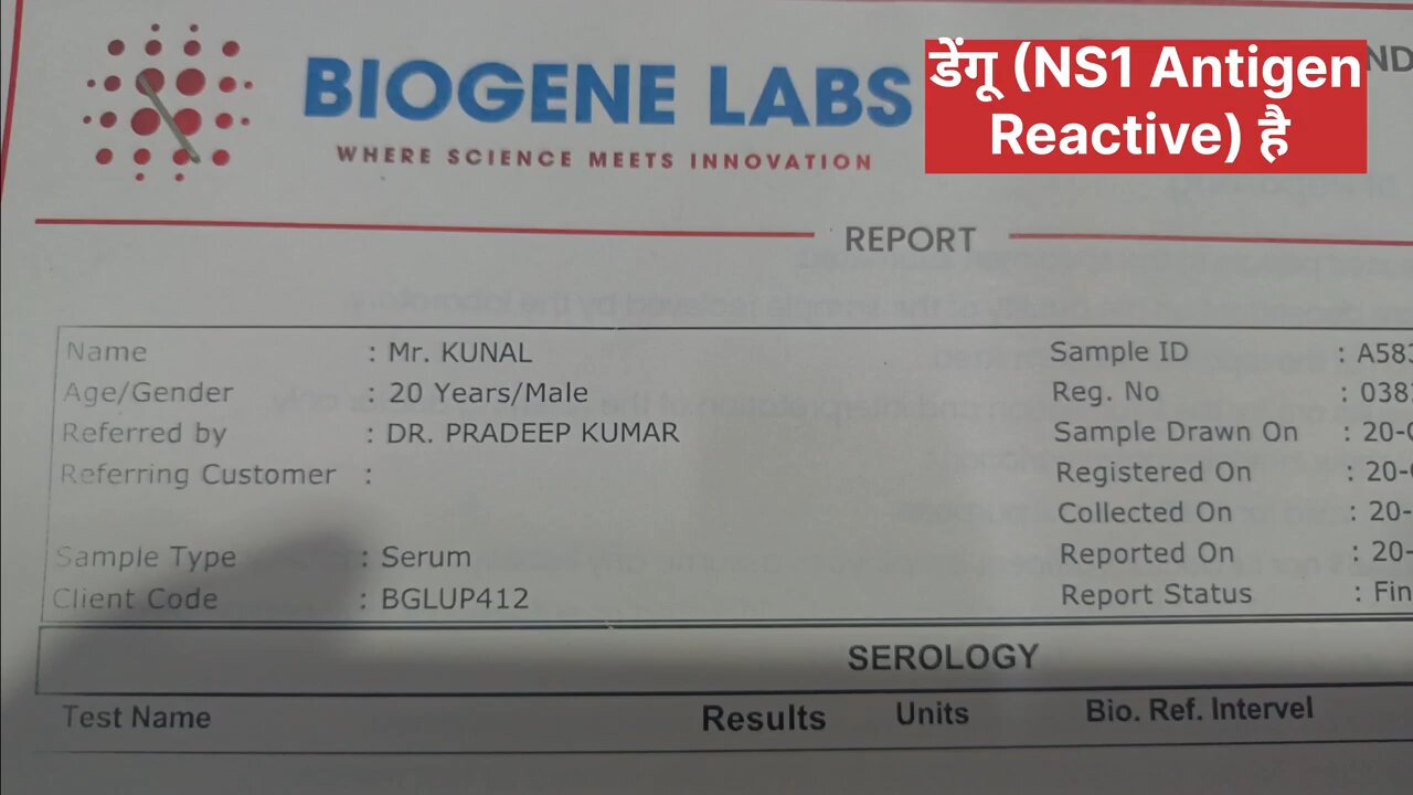 डेंगू बुखार में प्लेटलेट्स केवल 16 हजार रह गई लेकिन बिना भर्ती किए मरीज सही किया ।