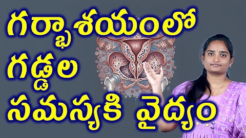 గర్భాశయంలో గడ్డల సమస్యకి వైద్యం Best Treatment For Uterine Wall Thickening | Adinomayosis Homeopathy