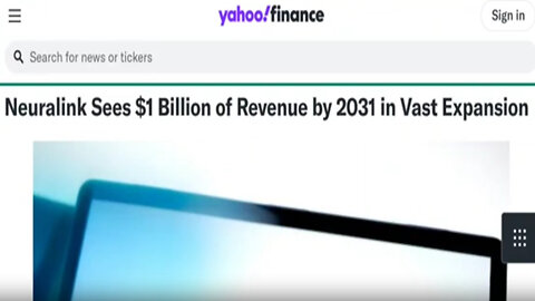 Neuralink expects to put its chips in 20,000 people a year by 2031!!!!