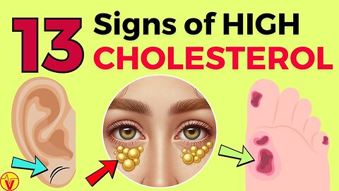 Reveal Thirteen Quiet Red Flags Hinting at Soaring Cholesterol! VJ22