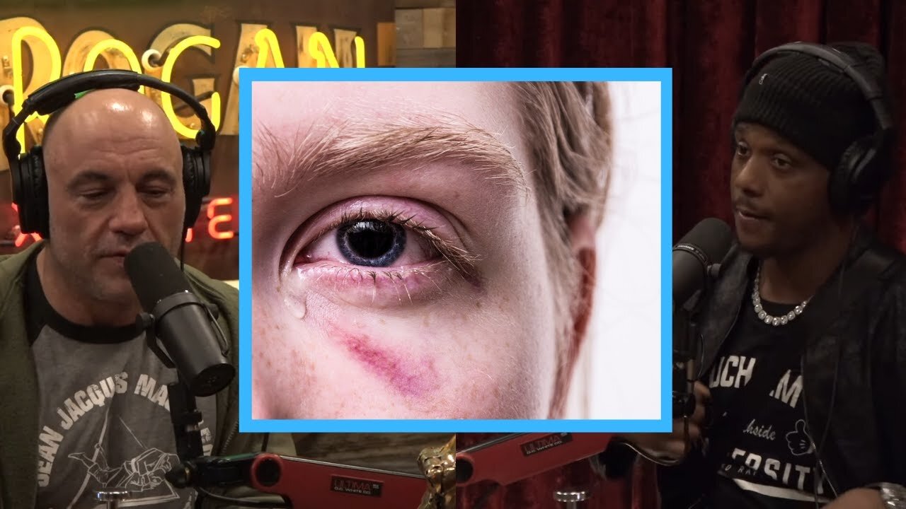 Joe Rogan & Jamahal Hill: This Sport Has A Huge Problem with Eye Injuries