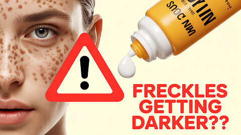 Can Freckles Fade? Shocking Truth You NEED to Know Now!"