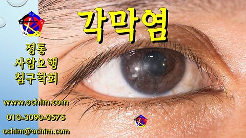 각막염 치료 방법 - 사암오행침, 사암침법, 오행침, 정통사암침