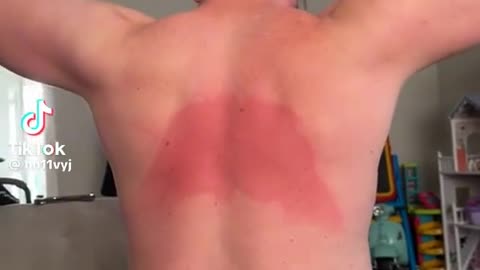 🌞😂 This needs to be a SUNBLOCK AD... or does it?! | Funny Commercial | FunFM
