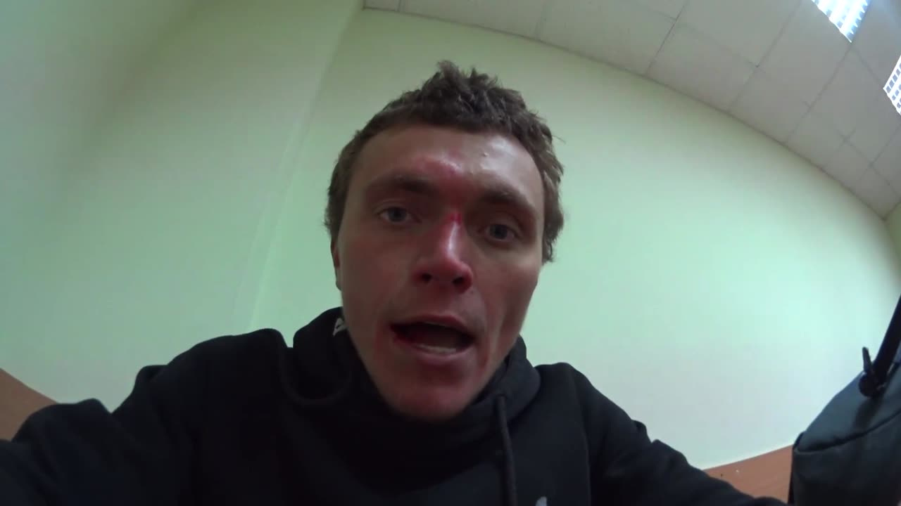 Фишая долбанули дрелью