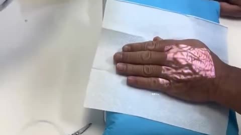 Spot Blood Vessels