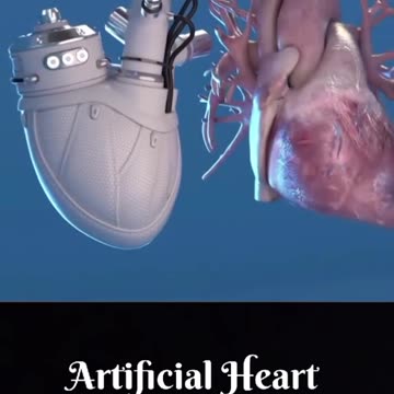 Artificial Heart 🩺💖💖💖💖