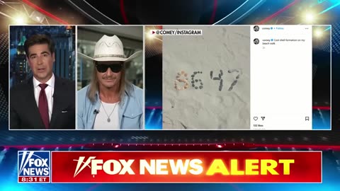 Kid Rock slams Comey for alleged Trump threat post: ‘TDS at the highest levels’