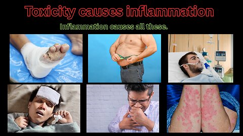 "Inflammation: The Silent Killer Lurking Inside You"