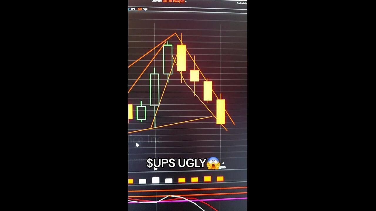 $UPS UGLY😱