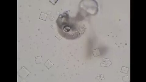 Nicotine Destroys Injectable Nanotechnology