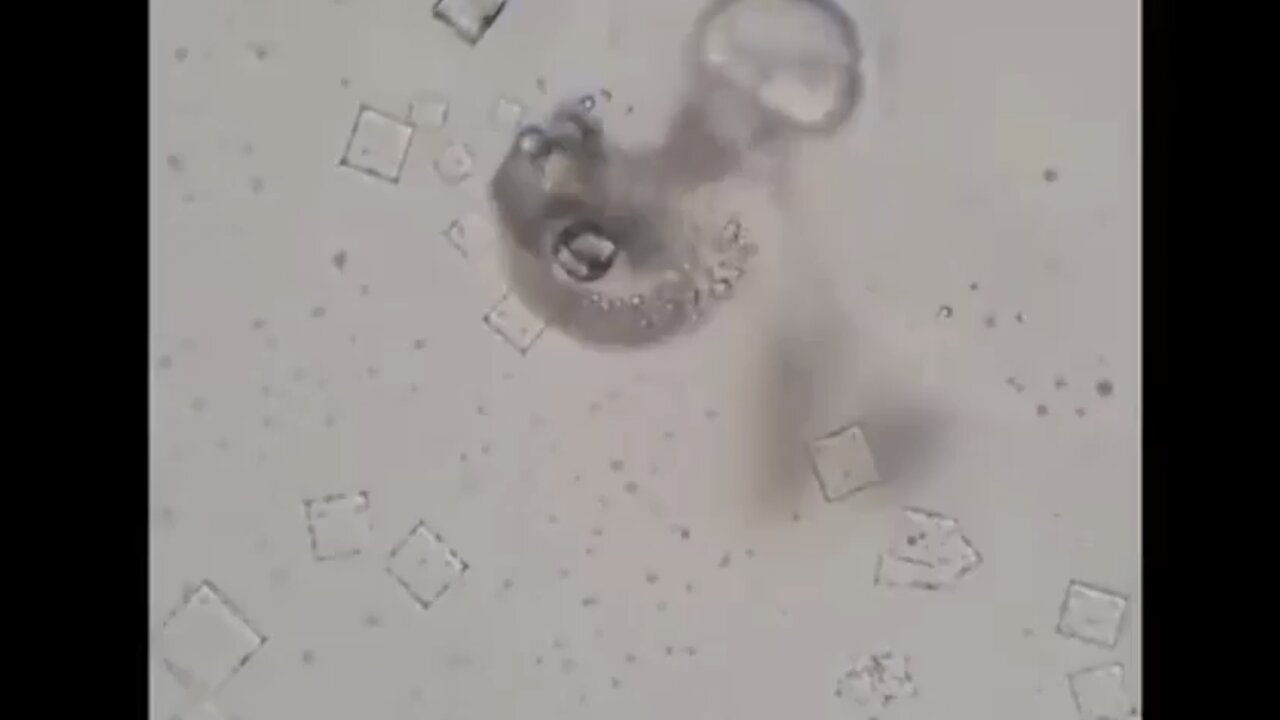 Nicotine Destroys Injectable Nanotechnology