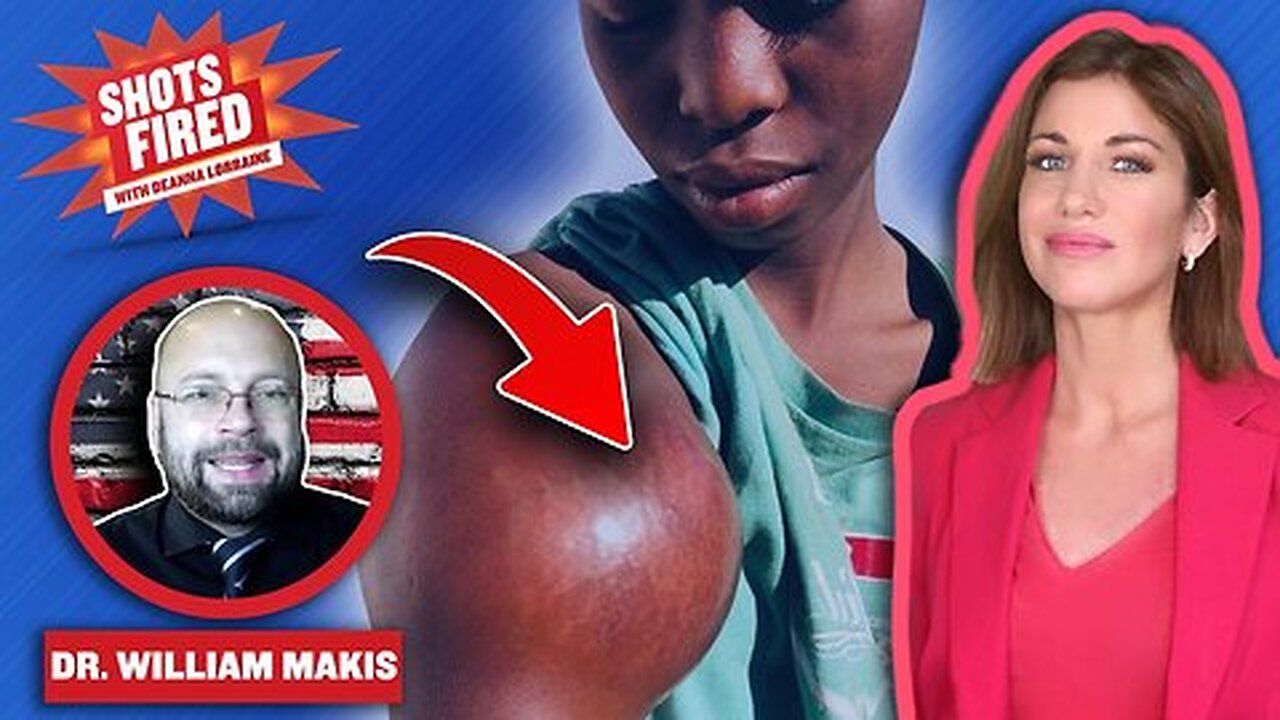 RERUN: Rare CANCERS Exploding all over the World! New Clinton Plane Crash Murder and more