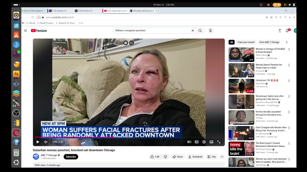 Black Man Who Randomly Punches White Woman Has New Victim - Over 20 Violent Attacks