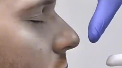 Nasal Bleeding Emergency Management – Stop Nose Bleed in Seconds!