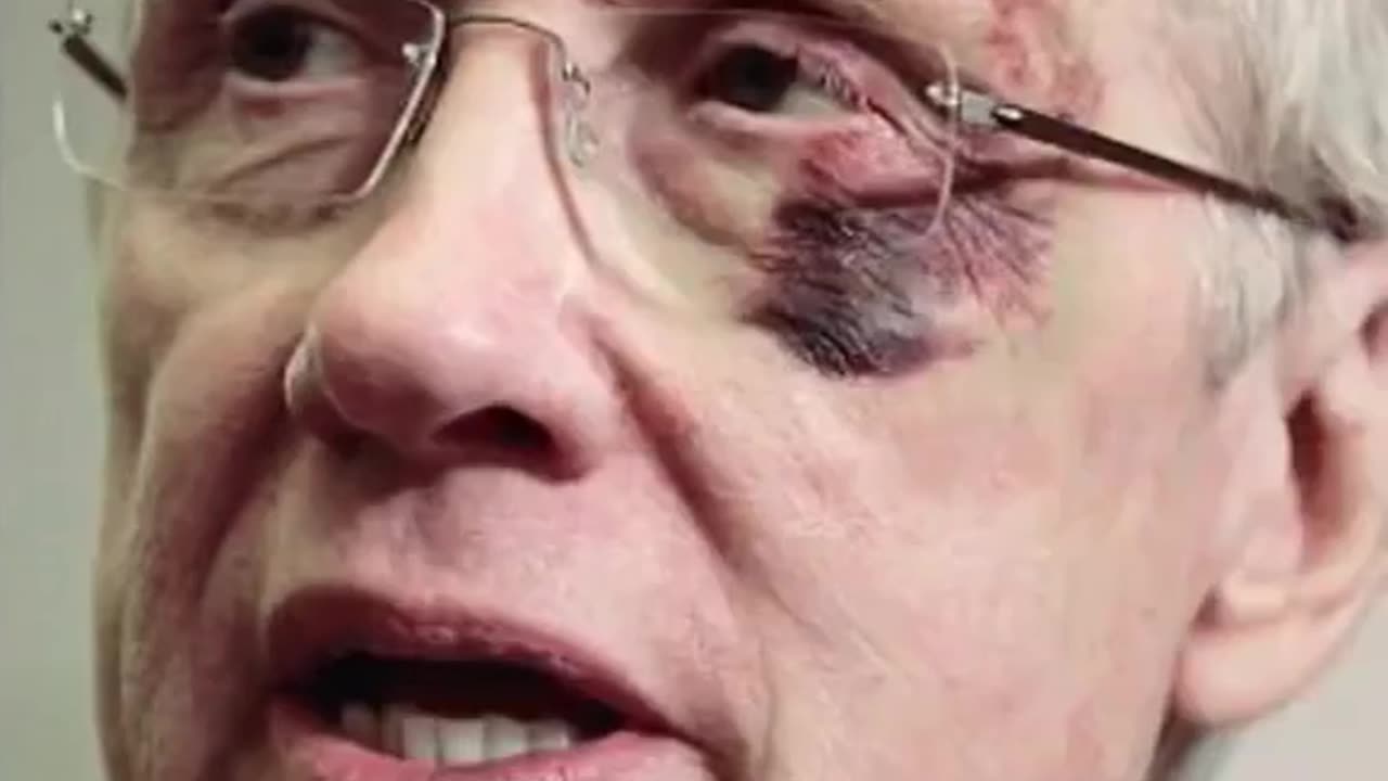 The “Black Eye” club,