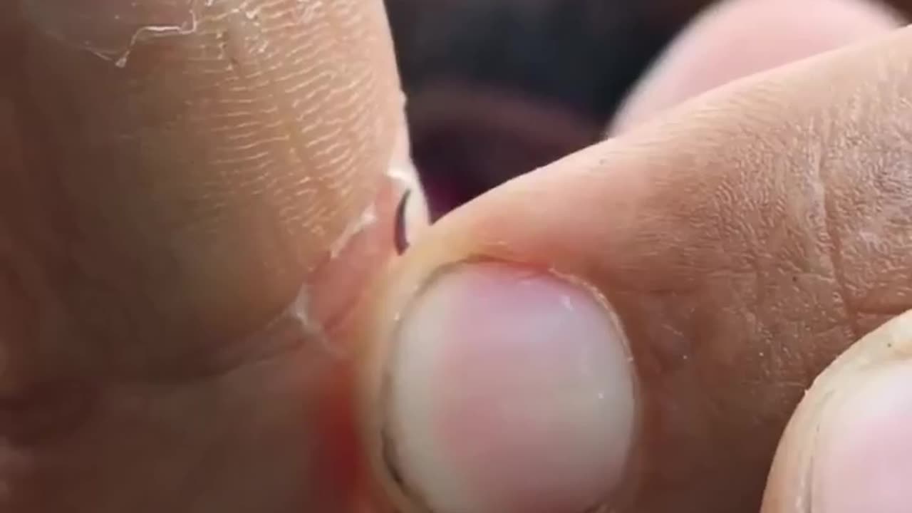 This is how Scorpion Sting Works