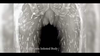 Parasite : The Killer Inside Us