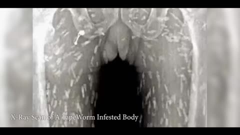 Parasite : The Killer Inside Us