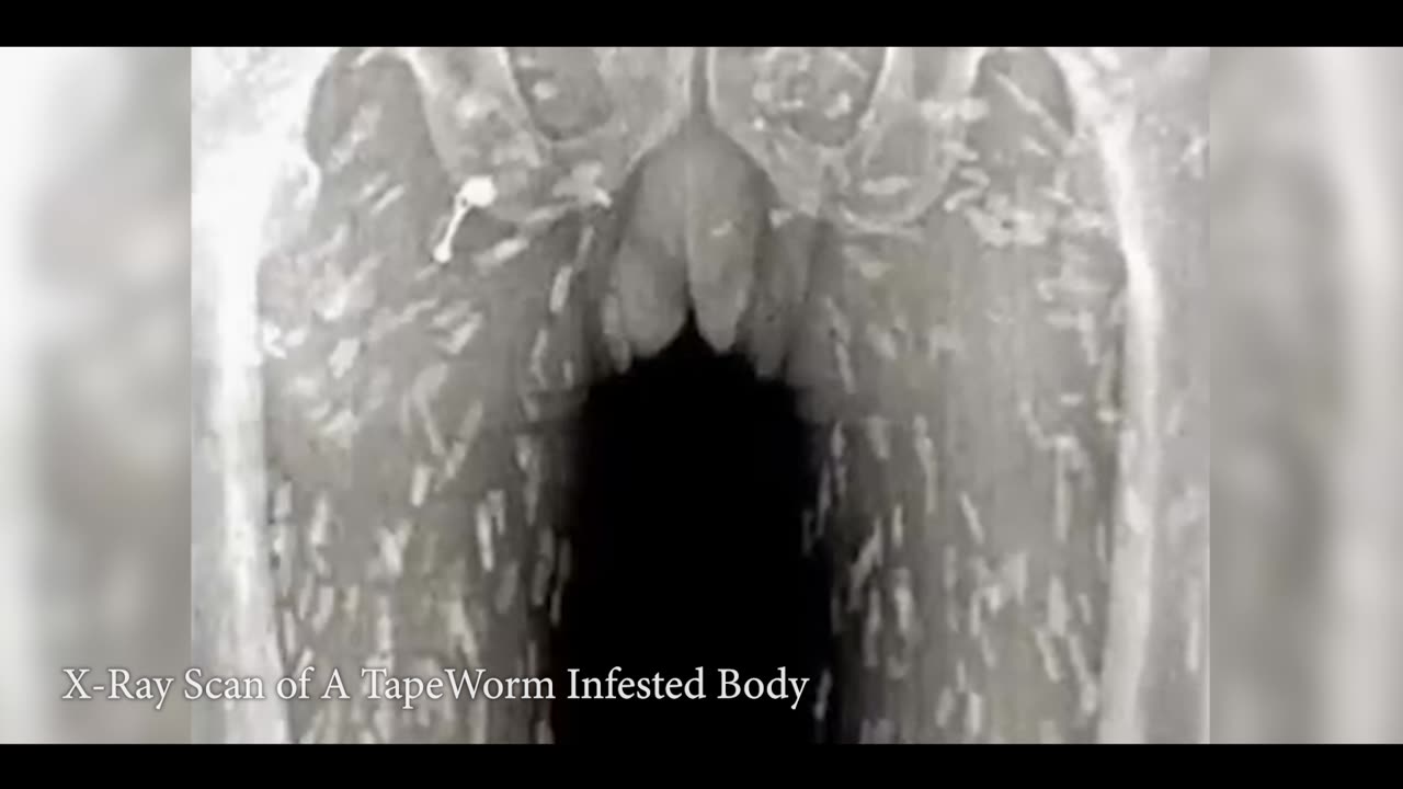 Parasite : The Killer Inside Us