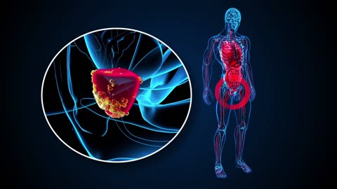 Treatment For Gall Bladder Stones | Gallbladder Stones Treatment