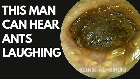 This Man Can Hear Ants Laughing