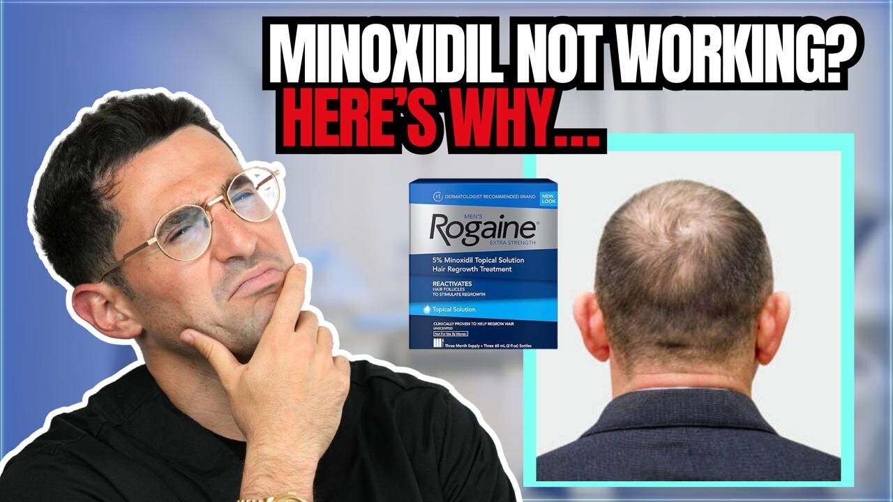 Doctor Explains Why Minoxidil Doesn’t Work for Everyone (and What You Can Do About It)