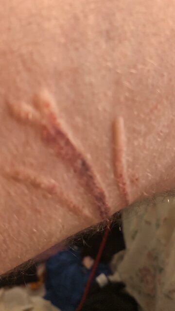 Myy dog had a seizure I took the damage!!