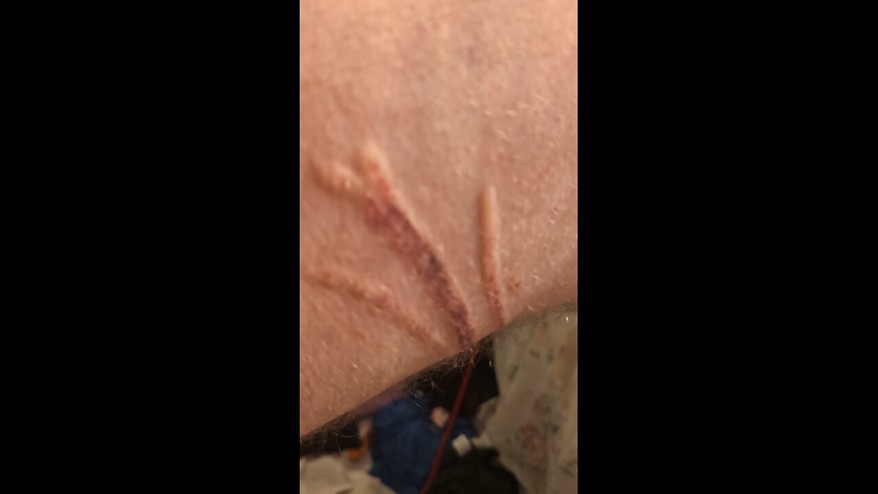 Myy dog had a seizure I took the damage!!
