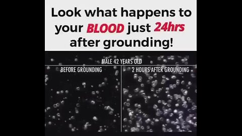 "Discover the Astonishing Changes in Your Blood After 24 Hours of Grounding"